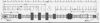 BORG & BECK BBH7572 Brake Hose